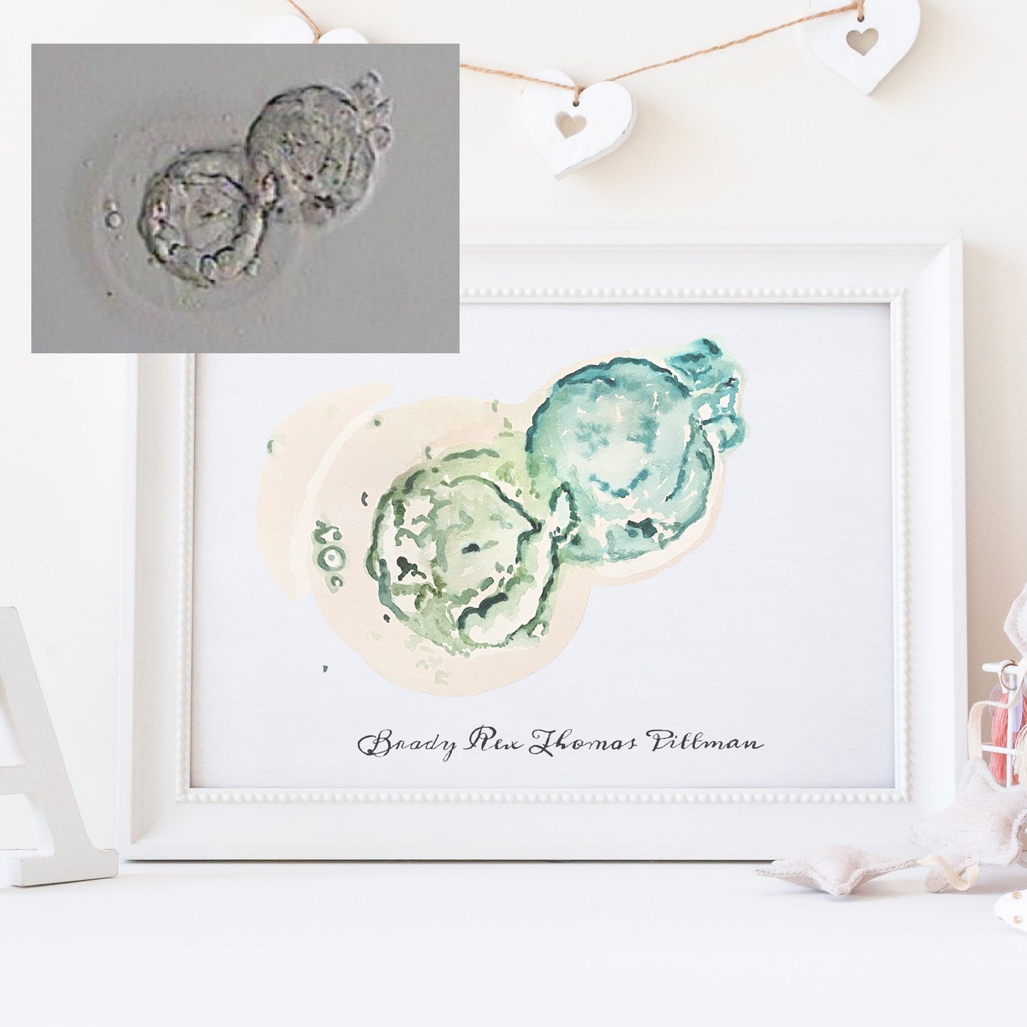 Custom Embryo Watercolor