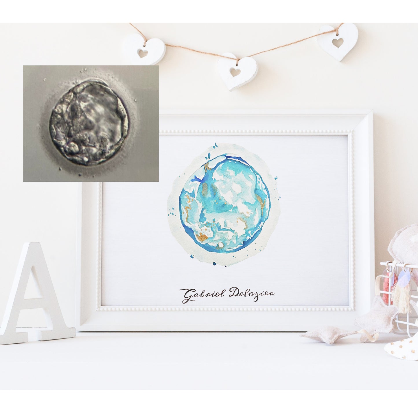 Custom Embryo Watercolor